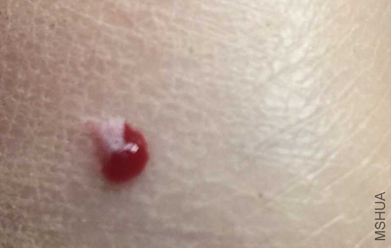 3547237