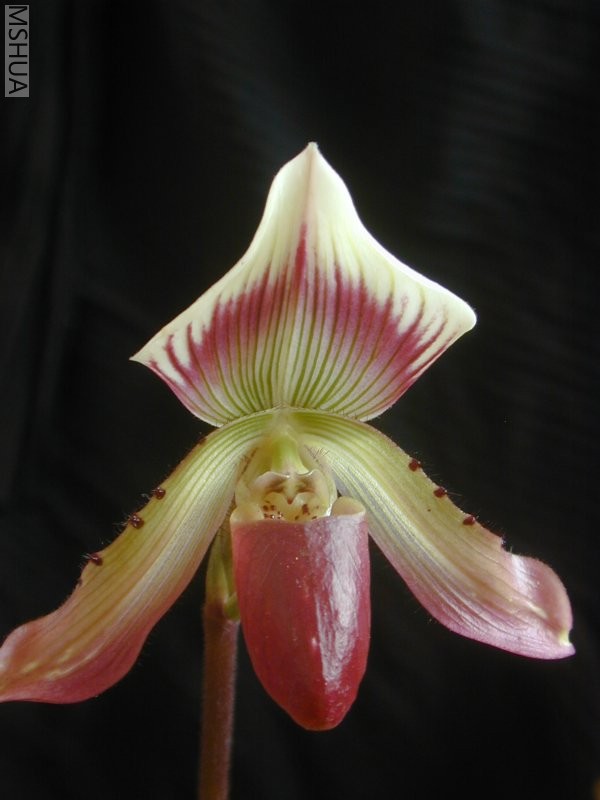 ��ת callosum.jpg